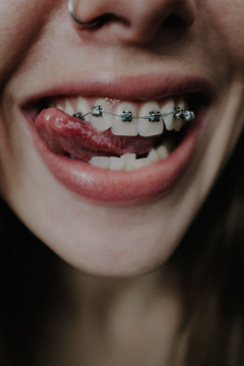 Patient smiling with dental braces